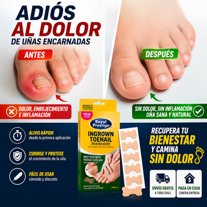 NailFix Pro™ 🦶🏻✨ Elimina el Dolor de Uña Encarnada (caja 30 uni)
